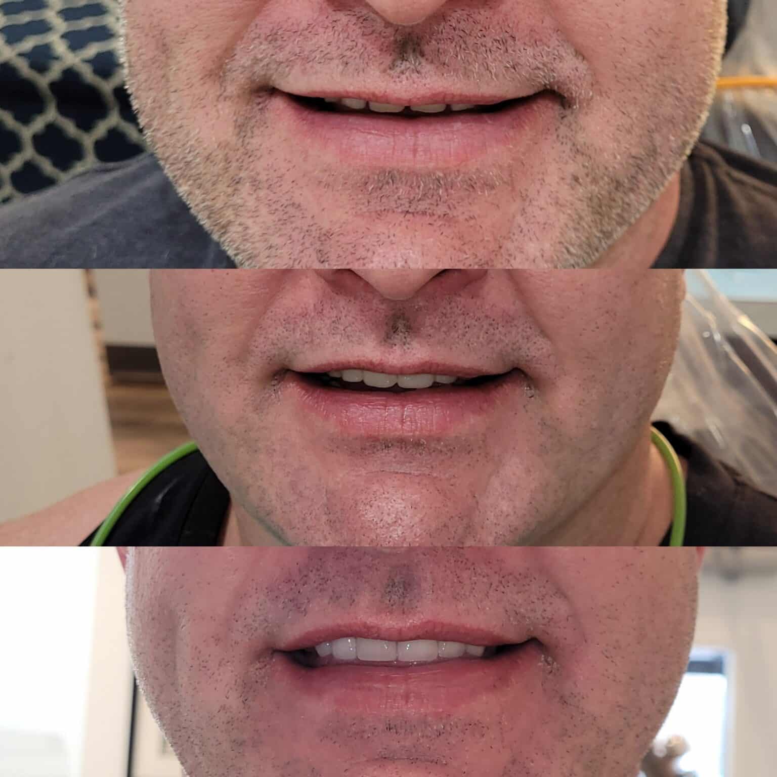 Colleyville Dentist — Azure Dental — Colleyville, TX